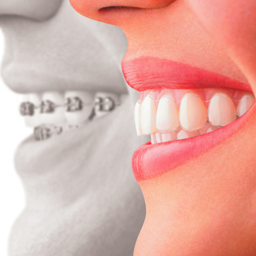 Orthodontie